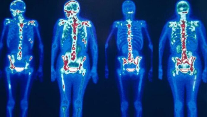 What Does Imaging Studies Reveal? - FotoLog