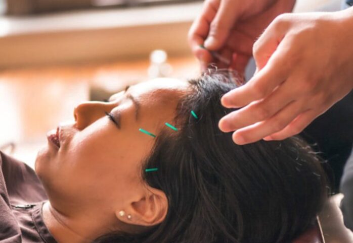 Can Acupuncture Help Treat Anxiety and Depression
