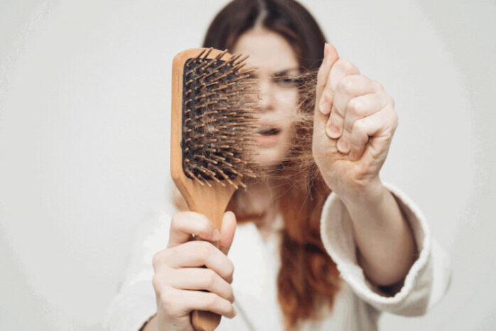Hair Loss