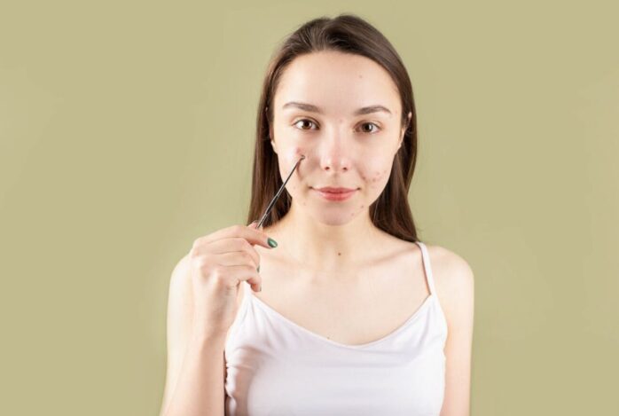 Acne and Mental Health