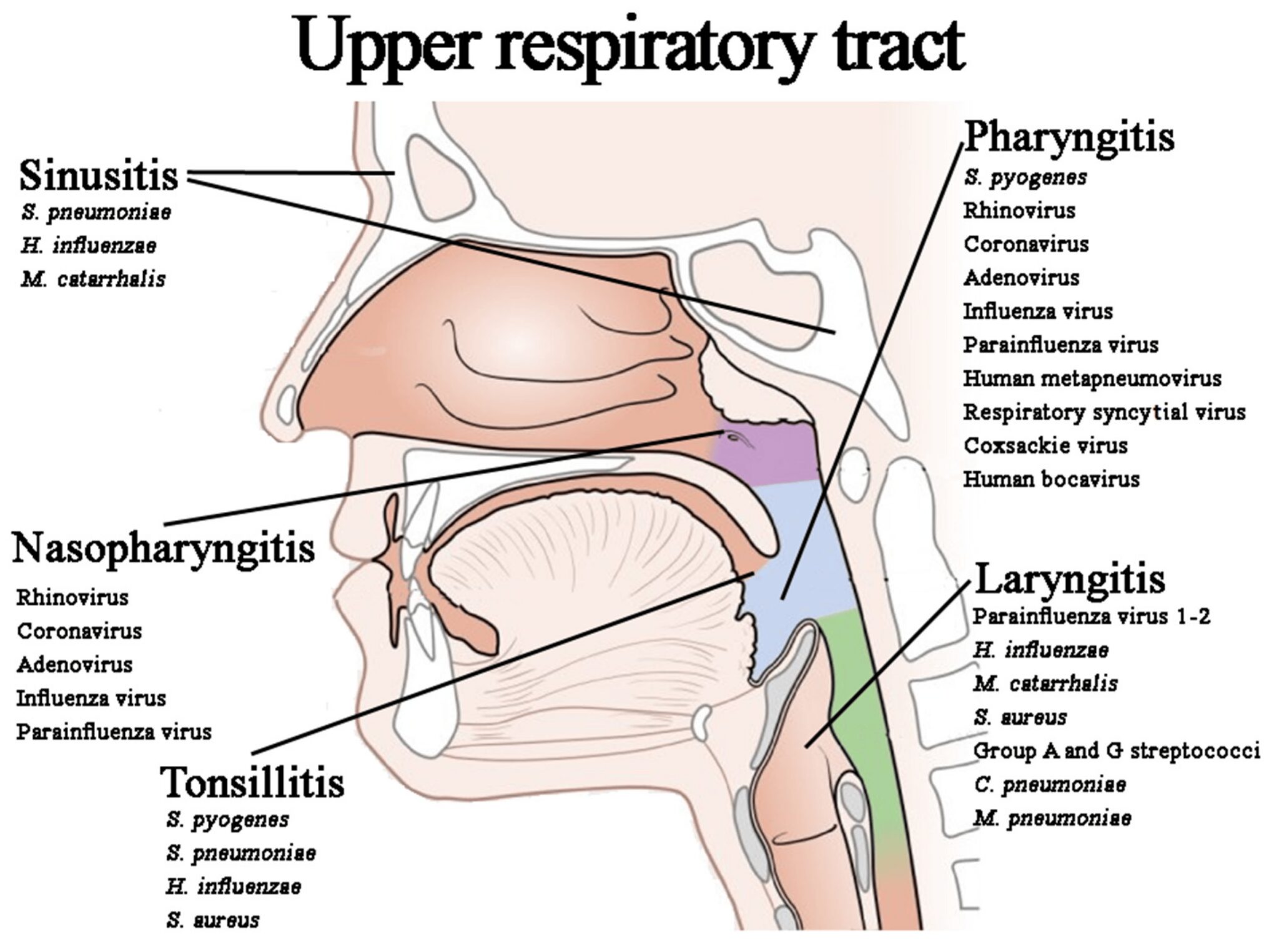 Respiratory Pathogen Array A Comprehensive Guide to Respiratory Pathogen Detection Panel ...
